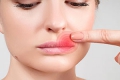 Заразен ли герпес на губах? Венеролог объяснила, можно ли целоваться